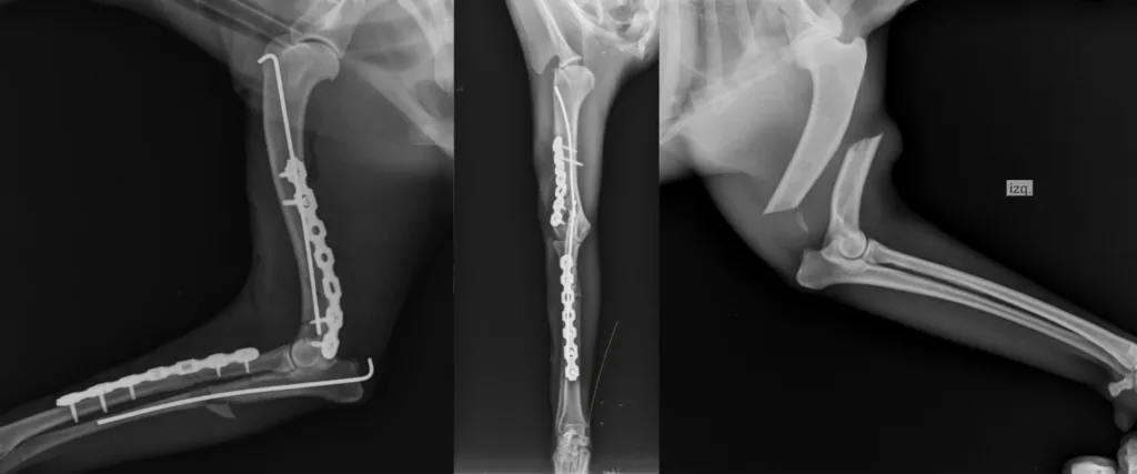C0095 Fracture Repair Mid-Shaft 2 Humerus, Radius / Ulna