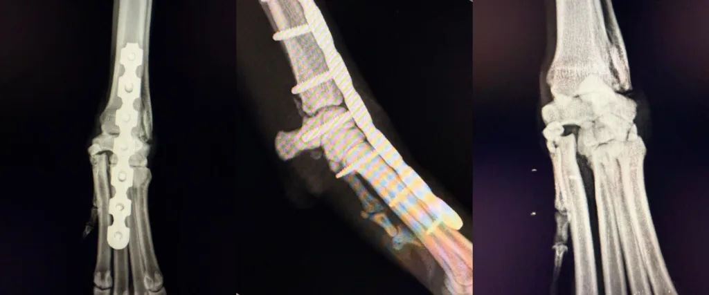 C0097 Arthrodesis Carpus Radius / Carpus / Metacarpus
