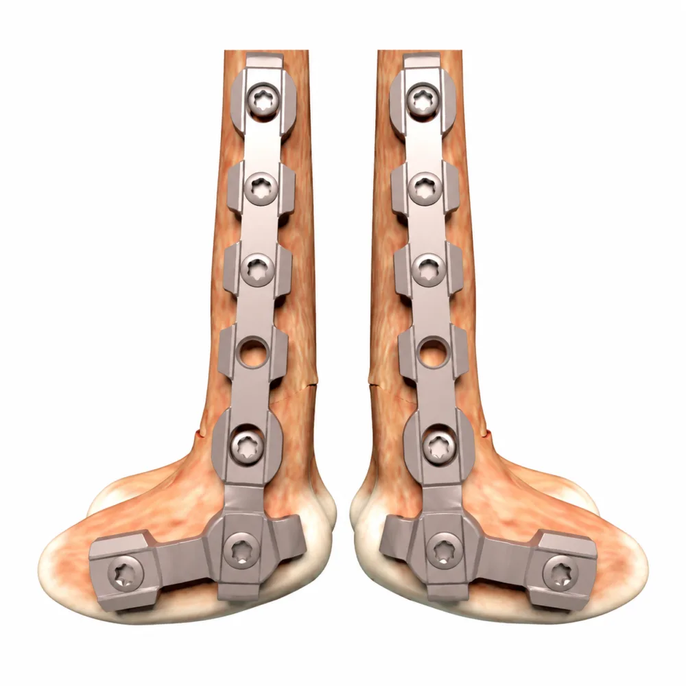 Left and right cross plate configurations on white