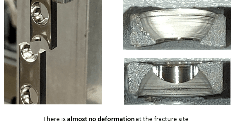 Typical Fracture 2